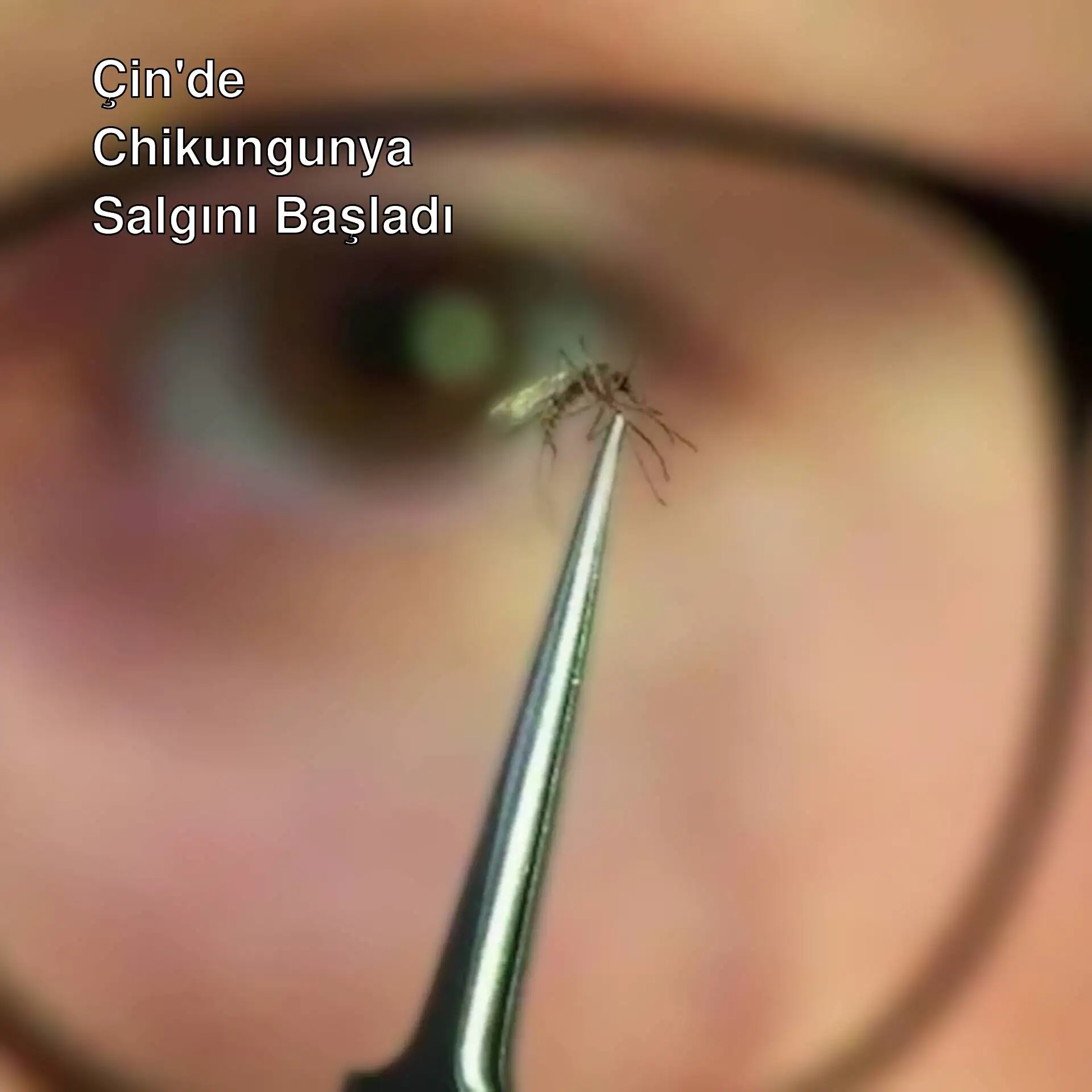 Çin'de Chikungunya virüsü nedeniyle artan vaka sayısı.
