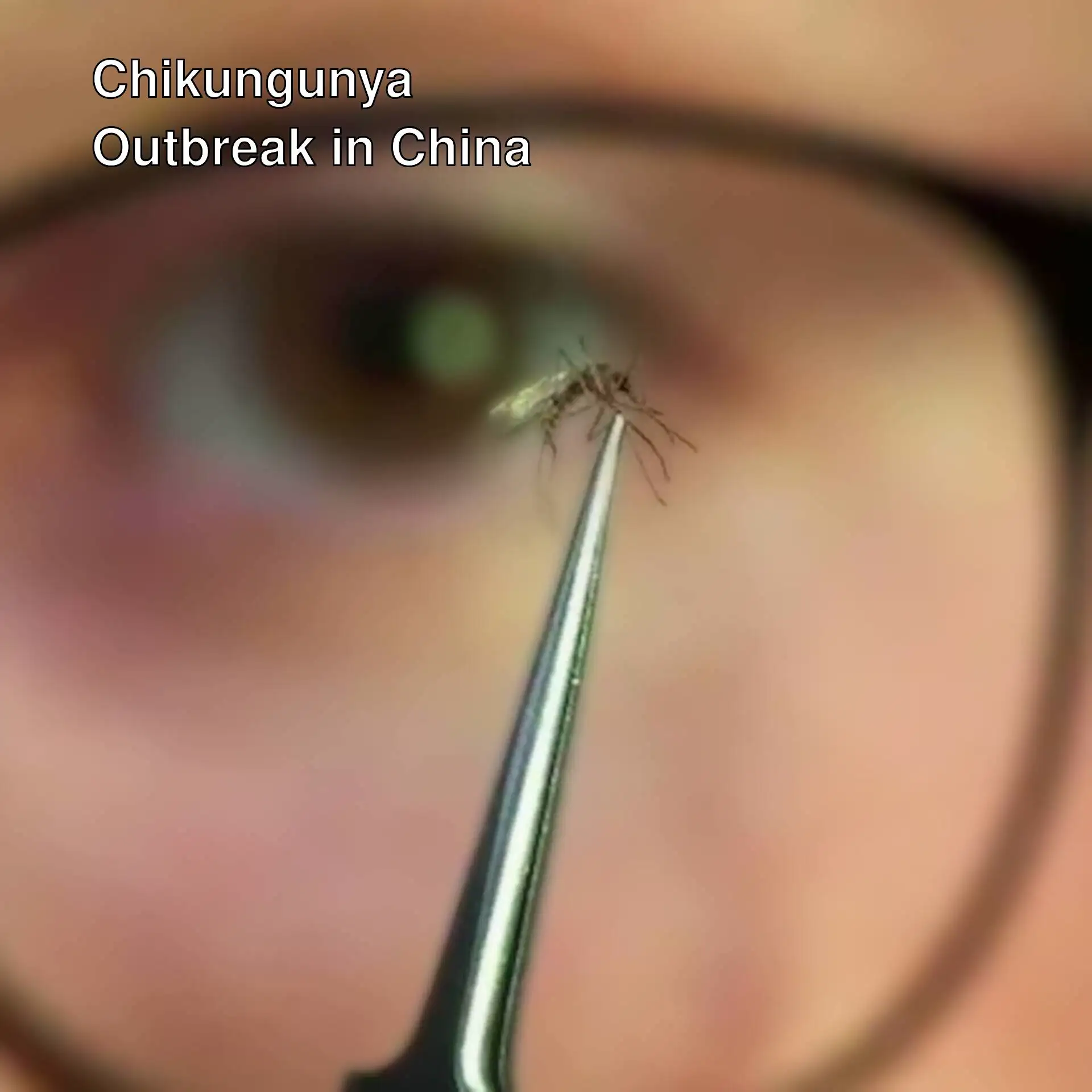 Rising case numbers due to Chikungunya virus in China.