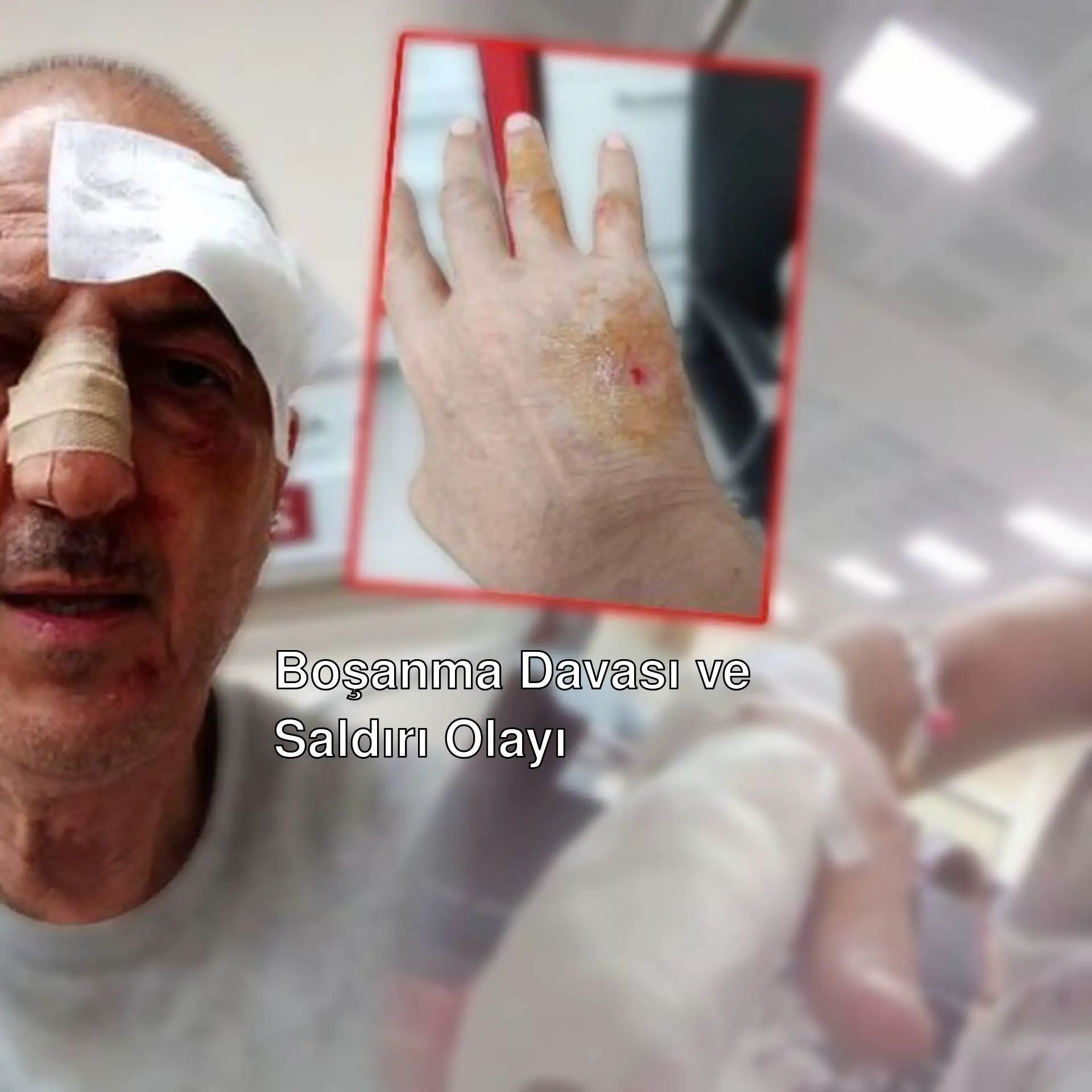 Burnu bandajlı bir adam ve kanlı eli. Burnu bandajlı bir adam ve kanlı eli.