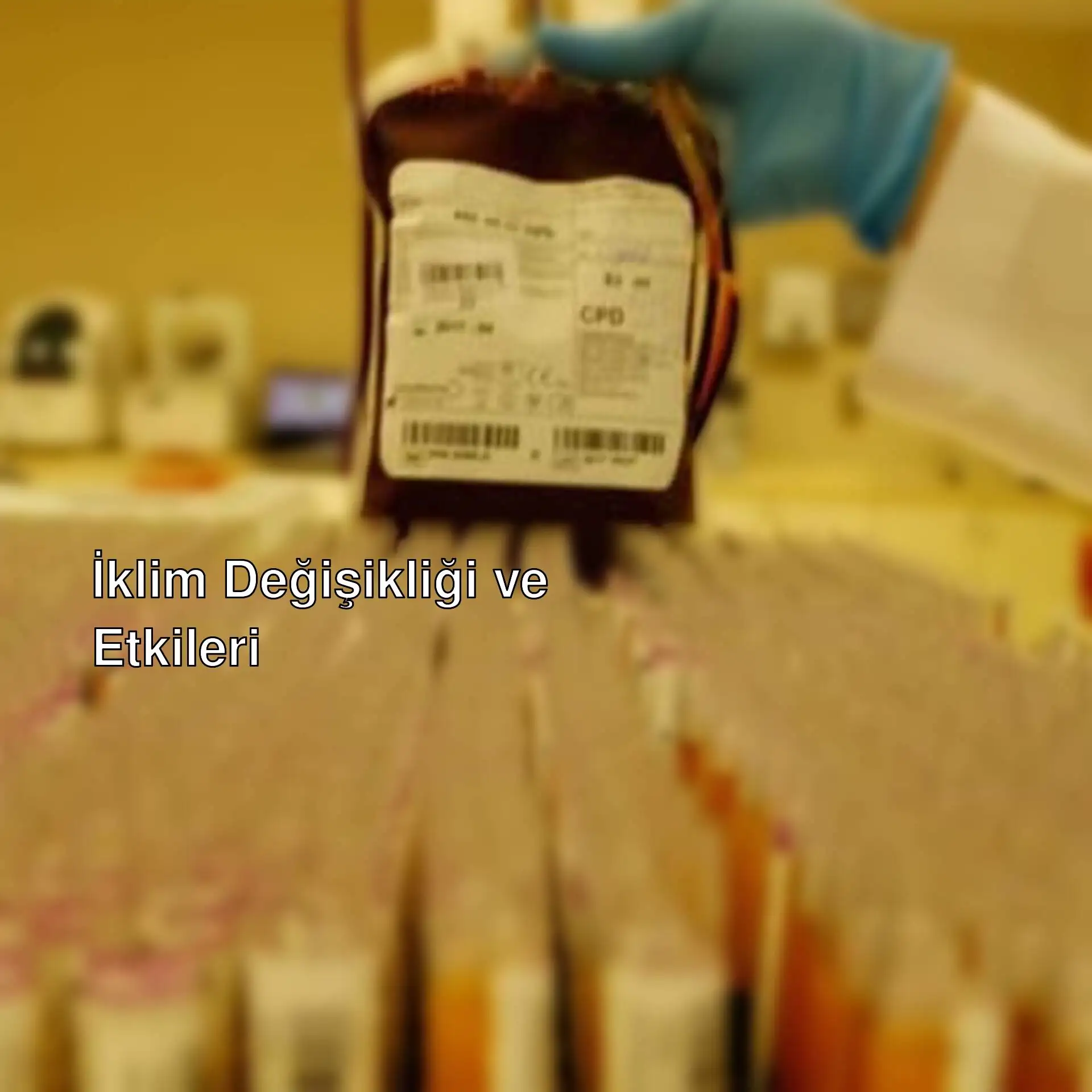 Kan torbası tutan bir el. Kan torbası tutan bir el.