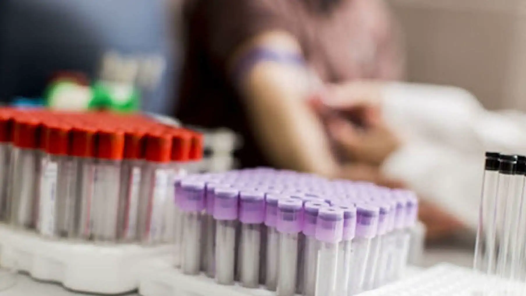 A group of test tubes.